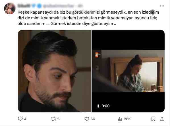 evrim alasya nin botokslu oyuncu devri kapandi sozleri gundem oldu